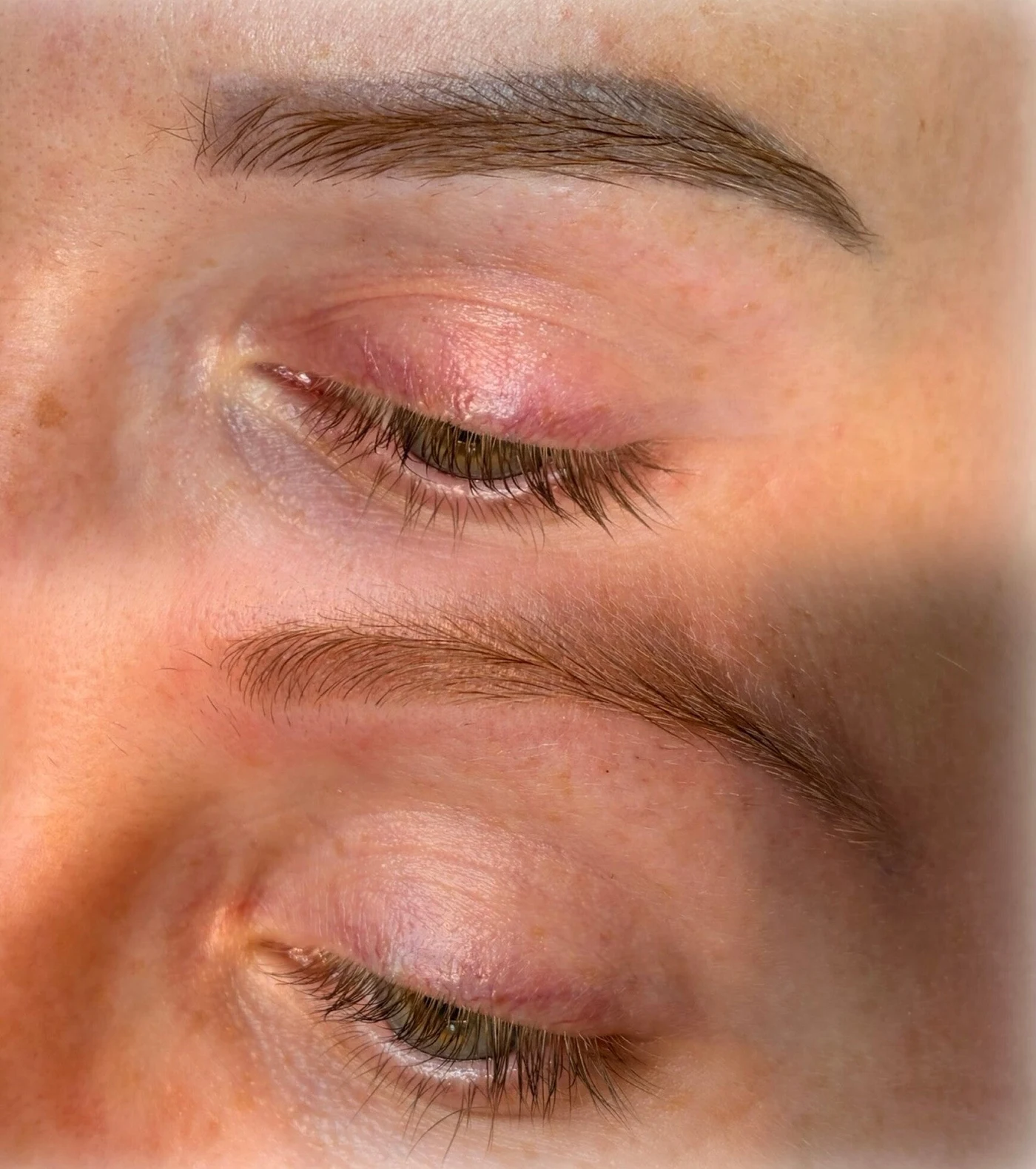 Laser removal PMU behandeling bij By Shay